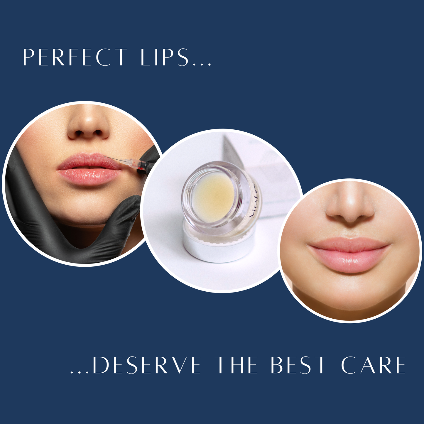 VitaLips® Post-Injection Recovery Lip Balm Case of 12